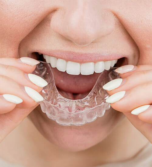 female with white nail polish inserting oral appliance into mouth